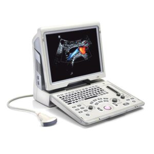 Ультразвуковая диагностическая система Z6, Shenzhen Mindray Bio-Medical Electronics Co., Ltd, КИТАЙ