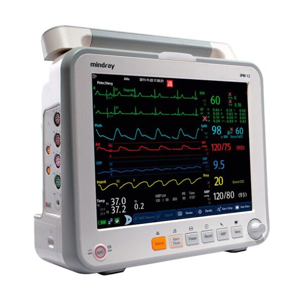 Монитор пациента ePM 12